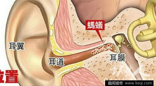 男子因右耳痒痛不止去医检查,医生看到都吓坏
