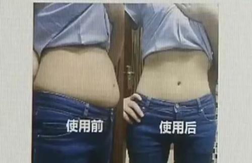 中药减肥瘦身包热销 align=center