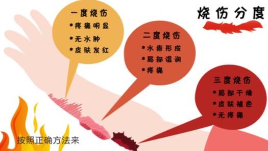 意外烧烫不用怕，常看烫伤科普小讲堂