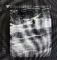 预防乳腺癌的有效方法，每个女性都应该了解