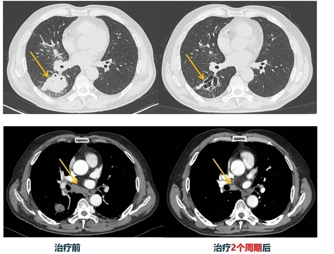 多学科协作、个体化诊疗是罕见肿瘤治疗的可行出路