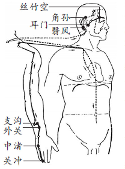 三焦经，独特的“调水要道”