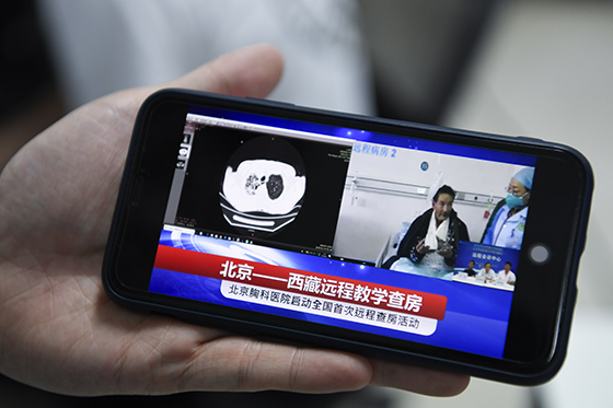 西藏病患北京问诊 全国结核病远程查房在北京胸科医院首现