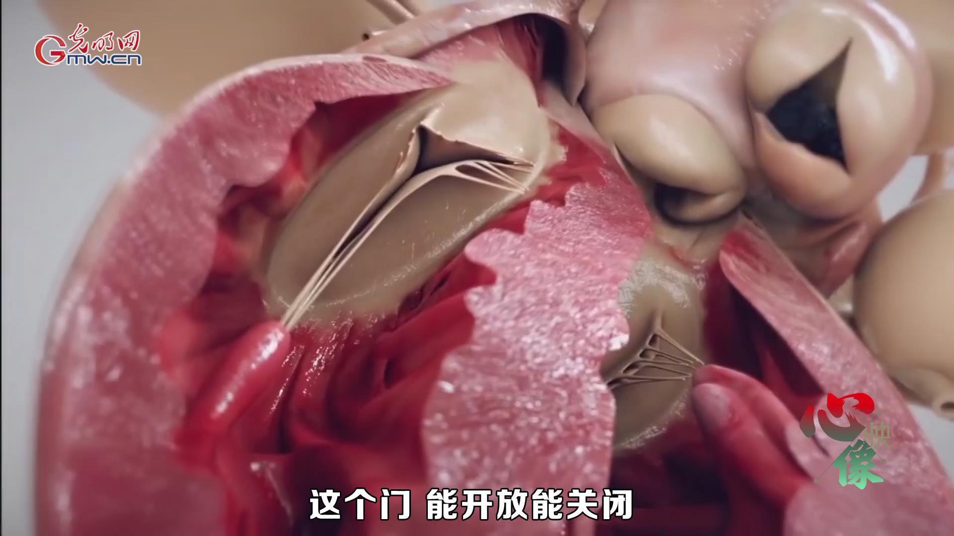 【光明卫生•心映像】刘巍：用不开胸的手术，保护最后一道生门