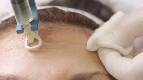 “鼠标手”纳入职业病目录是防治第一步