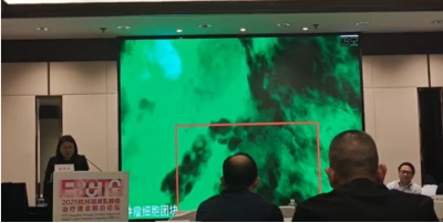 细胞级荧光导引技术EndoSCell®突破术中盲区