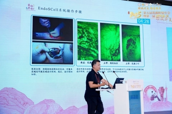 细胞级荧光导引助力外科手术精准化治疗