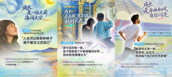 特应性皮炎不是普通湿疹！专家：别让瘙痒影响孩子健康