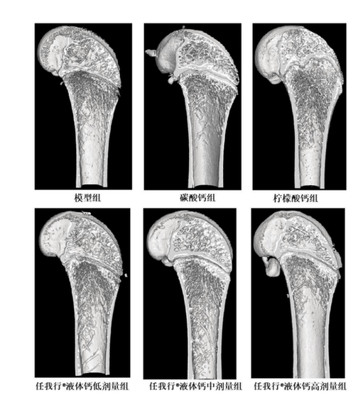 告别“单一补钙” 引领从“补钙”到“养骨”新范式