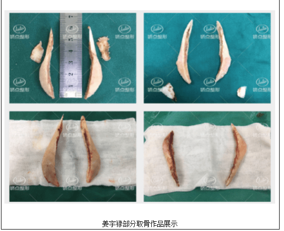 2018整形外科内镜与微创医师大会：探秘医美之都四级高难度整形资质手术