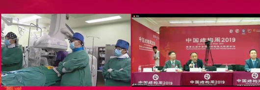 华西心外微创瓣膜团队：2019全国TAVR手术纪录，我们这样突破