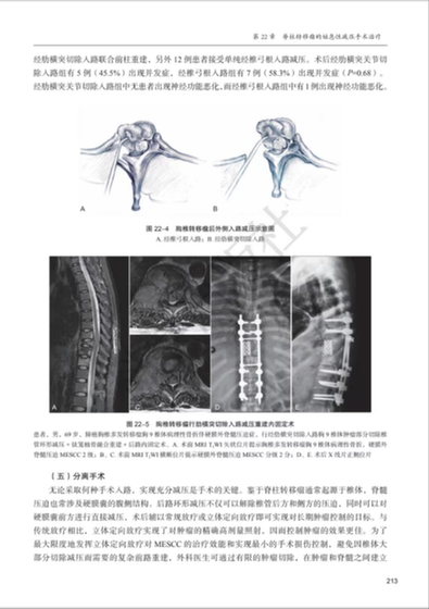 解放军总医院骨科医学部派驻第五医学中心骨科刘耀升专家团队学术专著《脊柱转移瘤基础与临床》出版发行