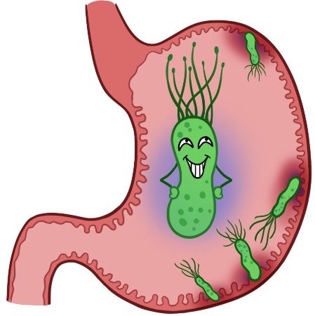 幽门螺杆菌卡通图片图片