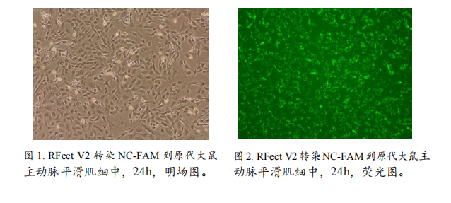 第二代新型 siRNA 转染试剂