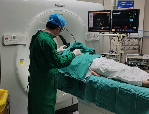 精准“微雕”神经 患者重展笑颜