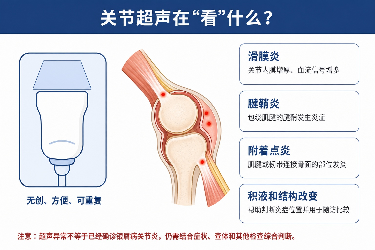 银屑病患者别忘查关节